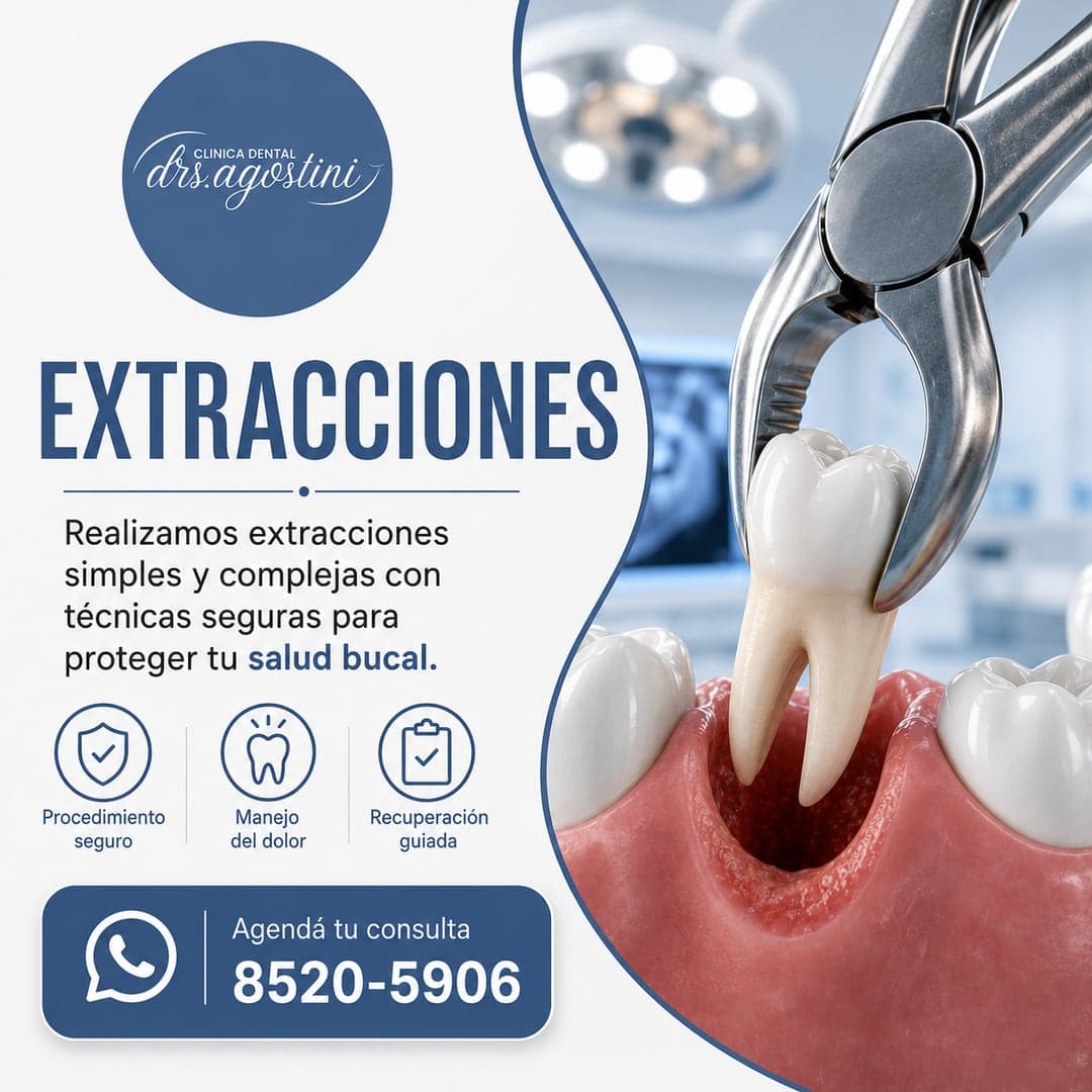 Extracciones Dentales en Cartago — Clínica Dental Drs. Agostini
